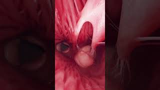 💓 Tricuspid amp Pulmonary Valves Guardians of Blood Flow 💓 anatomy [upl. by Grady]