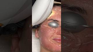 ASMR Laser Treatment [upl. by Rehportsirhc]