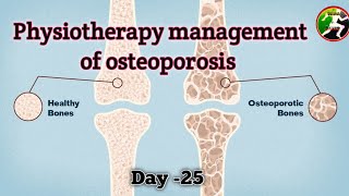 Day  25  Physiotherapy management of Osteoporosis  Osteoporosis management [upl. by Novyad985]