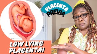 High Risk Pregnancy Placenta Concerns [upl. by Trygve]