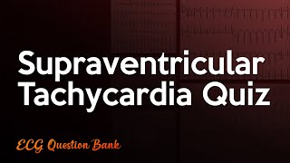 Supraventricular Tachycardia ECG Quiz [upl. by Jayne233]