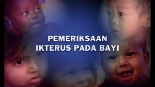 Pemeriksaan ikterus pada bayi”MTBS” [upl. by Naawaj]