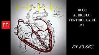 Arythmies Animation cardiaque et ECG  Bloc auriculoventriculaire 21 Shorts [upl. by Akemak]