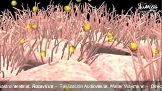 Infección Gastrointestinal por Rotavirus [upl. by Cresida]