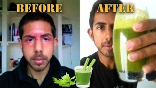 Juicing for Clear Skin  Why YOU should juice daily [upl. by Renee]