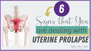 6 Signs that you are dealing with Uterine Prolapse [upl. by Aisenat]