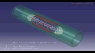 Balloon expansion of a closed cell stent [upl. by Benildis756]