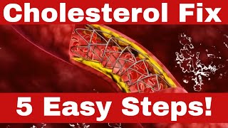 How to Reduce Cholesterol FAST  5 Proven Methods [upl. by Chas]