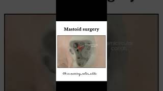 Mastoid surgery procedureanatomy reels hearttouching study youtube ytshorts ytviral [upl. by Wein]