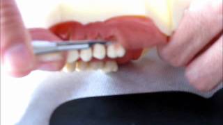 Cirurgia plástica periodontal em modelo Dentart [upl. by Ananna]