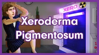 Xeroderma Pigmentosum Mnemonic for USMLE [upl. by Rondon174]