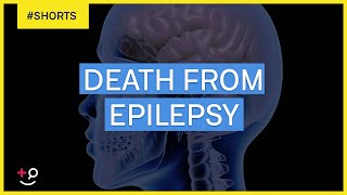 Can You Die From Epilepsy Shorts [upl. by Secnirp]