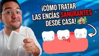 ¡CÓMO CURAR LAS ENCÍAS INFLAMADAS y SANGRANTES EN CASA  ELIMINA LA GINGIVITIS 😋 [upl. by Ysdnil35]