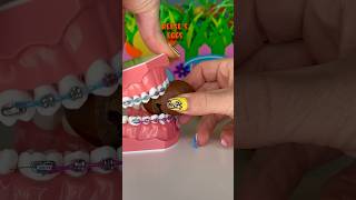 EASTER CANDY YOU CAN EAT WITH BRACES 🦷🐥 ORTHODONTIST REACTS CRUNCHY ASMR TEETH [upl. by Ydollem]