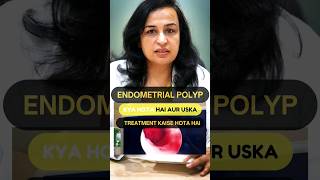 What is an Endometrial Polyp amp hows it treated  Endometrial Polyp in Hindi  Dr Nymphea Walecha [upl. by Noyerb]