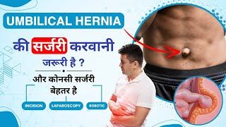 What is Umbilical Hernia in Hindi  Umbilical Hernia  Causes Recovery Symptoms amp Treatment [upl. by Bowne]