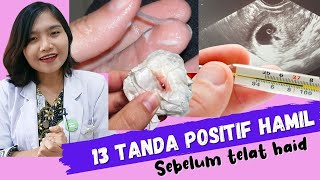 13 Tanda Positif Hamil sebelum Telat Haid  dr Emasuperr [upl. by Blaire374]