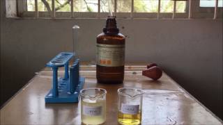 Albumin Detection in Urine  Sulfosalicylic Acid amp Nitric Acid Test for Urine Analysis  ENGLISH [upl. by Nandor451]