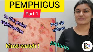 SKIN LESIONS PEMPHIGUS PART1 [upl. by Enobe]