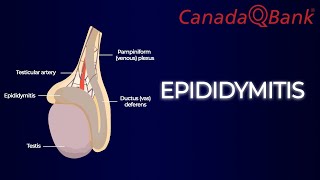 Epididymitis [upl. by Hegarty694]