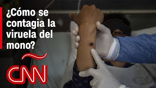 ¿Cómo se contagia la viruela del mono mpox que fue declarada emergencia internacional por la OMS [upl. by Danielson]