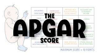 Apgar Score Made Easy  newborn assessment calculation interpretation limitations mnemonic [upl. by Toni]