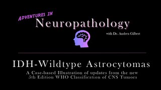 IDH  Wildtype Astrocytoma Update from the 5th Edition WHO Classification of CNS Tumors [upl. by Peterec74]