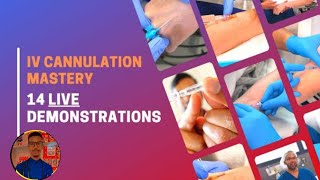 IV CANNULATION MASTERY  14 LIVE DEMONSTRATION [upl. by Debera]