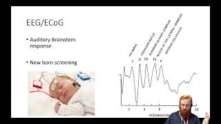 Electrophysiology 3  EEG and ECoG [upl. by Blair393]