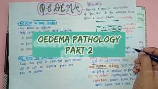 Oedema  Types Causes Symptoms amp Treatment  Part 2  Pathology [upl. by Eelek]