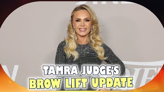 Tamra Judge Faces Intense Swelling After Brow Lift Recovery Update from RHOC Star [upl. by Francyne]