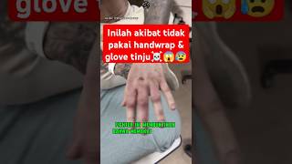 Jgn coba² gk pake glove klo GK mau kek gini ☠️😰 boxing boxingskill fight mma bangghalyh [upl. by Ellehsem]