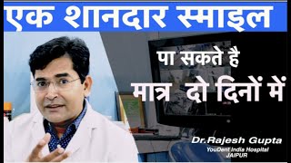 कैसे पाये एक खूबसूरत स्माइल बस दो दिन में ॥ अब दांतों की खूबसूरती में कोई compromise नही youdent [upl. by Ynnot]