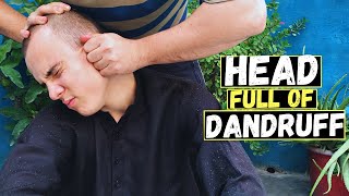 Dandruff Head Heavy Oily Head Massage ASMR To Relief Headache Neck amp Head Massage [upl. by Gilligan]