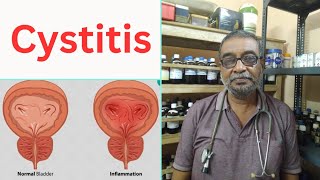 Cystitis  DrAniruddhaDe [upl. by Natalia920]