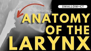 Larynx Anatomy  Radiology anatomy part 1 prep  CT interpretation [upl. by Anaicul548]