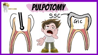 PEDIATRIC DENTISTRY  PULPOTOMY  Types Indications Procedure [upl. by Floria79]