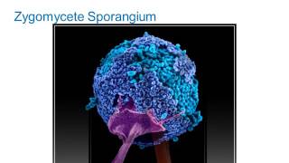 Identification of Filamentous Fungi Hyaline Monomorphic Fungi Part 1 Hot Topic [upl. by Essinger]