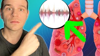 5 Essential Lung Sounds You MUST Know With Audio Examples [upl. by Atikal]