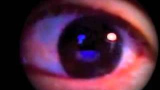 Fase REM  Rapid Eyes Movements [upl. by Diarmid]