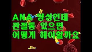 항핵항체 ANA 양성인데 관절통 있으면 어떻게 할까 Antinuclear antibody [upl. by Eremihc]