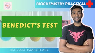 Benedict Test URINE TEST FOR SUGAR  BIOCHEMISTRY PRACTICAL with viva questions [upl. by Naus]