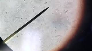 Bacillus Cereus Motility [upl. by Arod801]