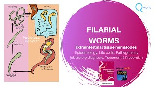 Filarial worms Wuchereria bancrofti Brugia malayi Mansonia Loa loa Onchocerca volvulus ampmore [upl. by Regina]