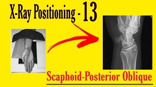 Scaphoid Posterior Oblique X Ray Positioning  X Ray Positioning for Radiographers [upl. by Hanas]