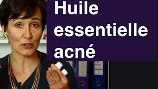 Huile essentielle acné  laquelle préférer [upl. by Goldy877]