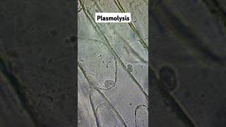 Plasmolysis and Osmosis biology gcse [upl. by Gnoix]