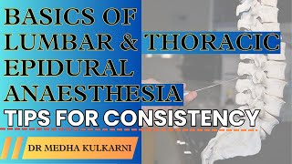 Mastering Epidural Anesthesia Essential Tips for Consistency I Dr Medha Kulkarni [upl. by Lenes]