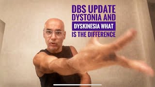 Dbs update dyskinesia and dystonia [upl. by Kramlich]