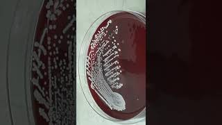 Growth Character of Staphylococcus hominis on Blood Agar Colony Morphology and Diagnostic Insights [upl. by Utas565]